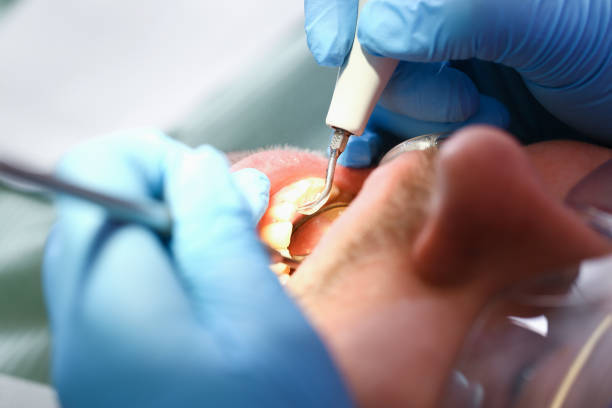 Best Urgent Tooth Repair  in Lake Bryan, TX