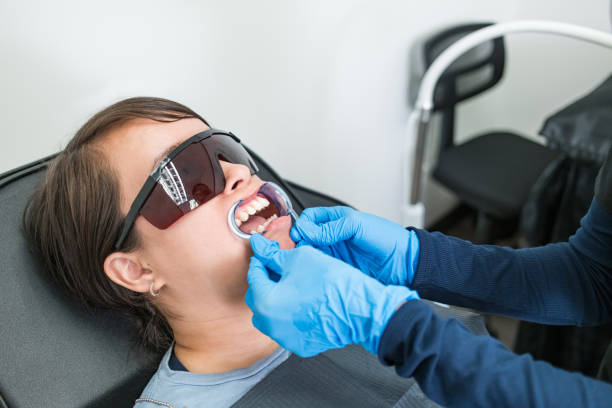 Best Chipped Tooth Repair Near Me  in Lake Bryan, TX